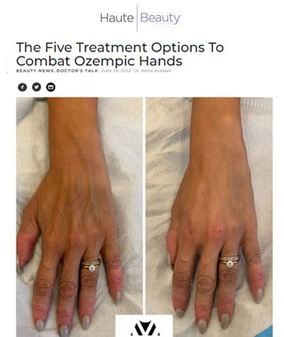 Dr. Avaliani Media Feature